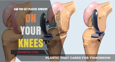 Knee Plastic Surgery: Exploring Options for Aesthetic and Functional Enhancements