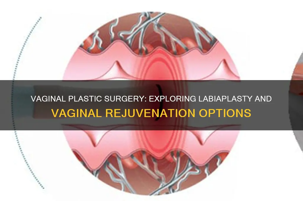 can you get plastic surgery on your vag