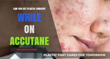 Plastic Surgery on Accutane: Risks, Timing, and Expert Advice
