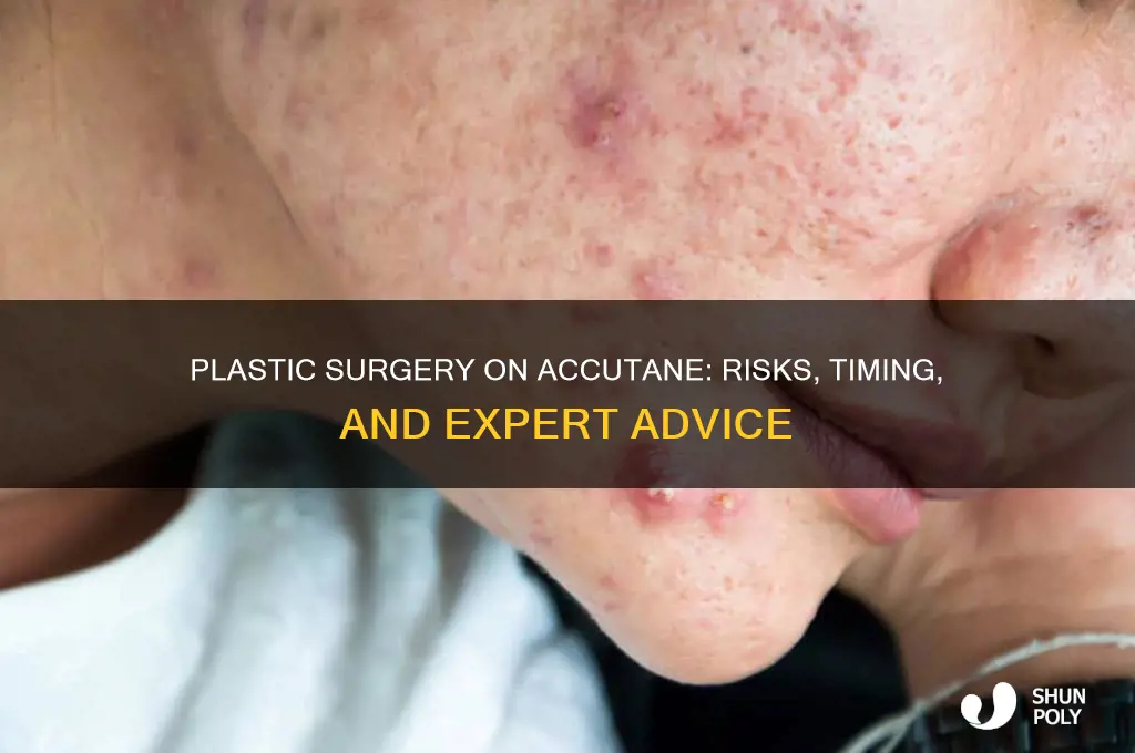 can you get plastic surgery while on accutane