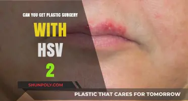 Plastic Surgery and HSV-2: What You Need to Know