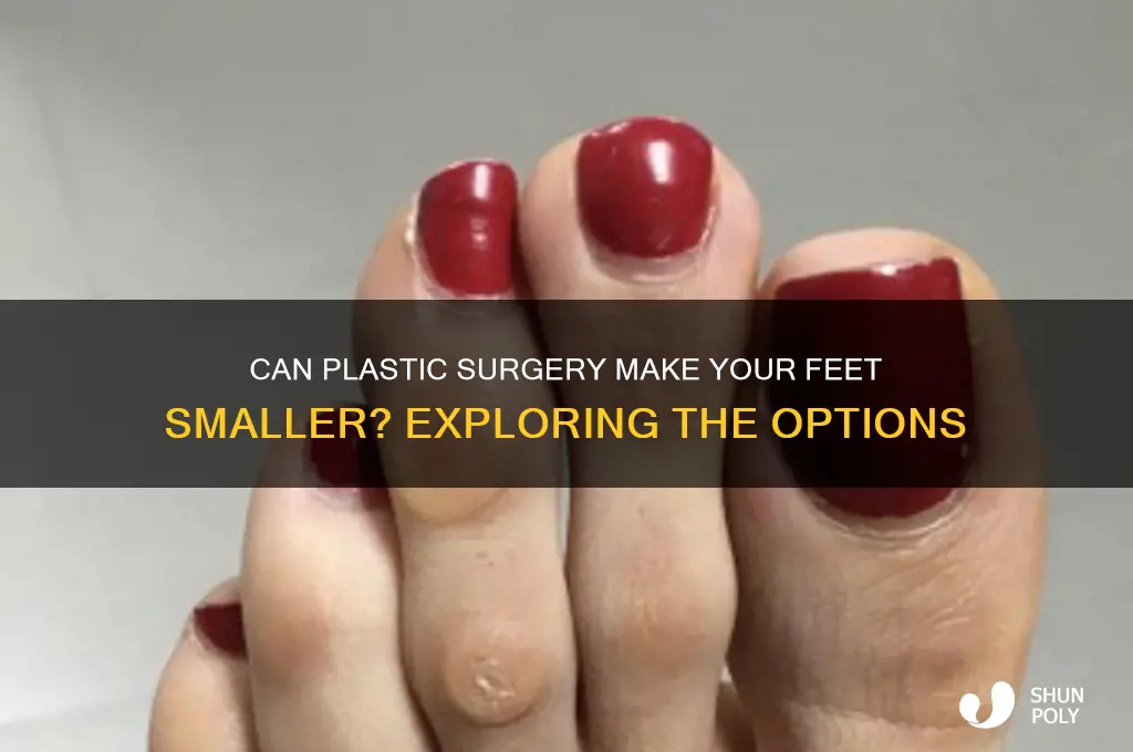 can you make your feet smaller plastic surgery