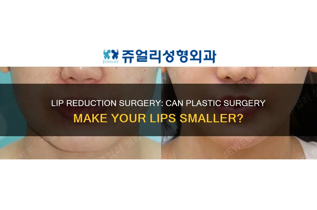 can you make your lips smaller through plastic surgery
