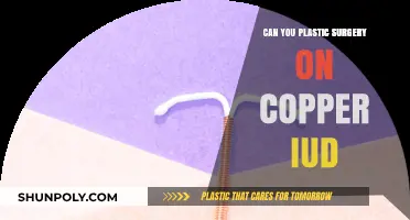 Copper IUD and Plastic Surgery: What You Need to Know