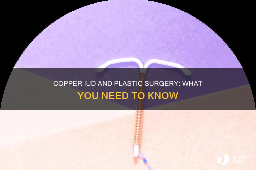 can you plastic surgery on copper iud