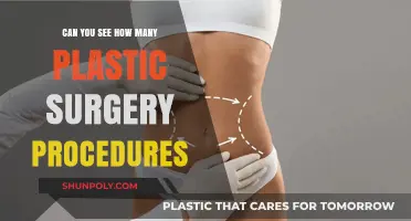 Unveiling Plastic Surgery Trends: Tracking Procedures and Their Popularity