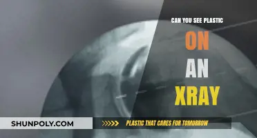 Unveiling the Truth: Can X-Rays Detect Plastic?
