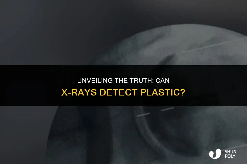 can you see plastic on an xray