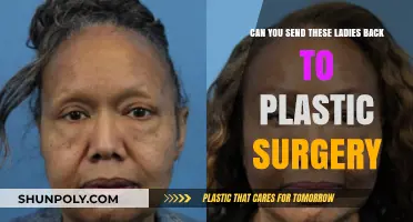 Revisiting Plastic Surgery: Should These Ladies Return for More?