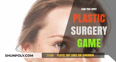 Spot the Plastic Surgery: A Fun Game to Test Your Eye