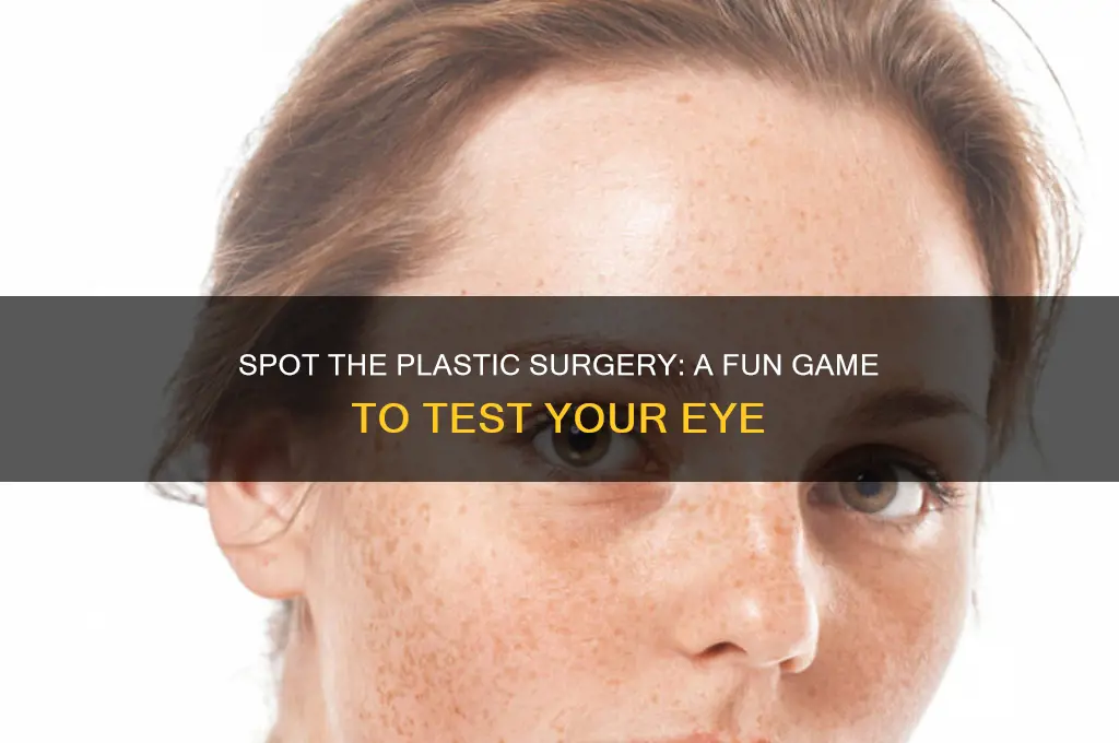 can you spot plastic surgery game