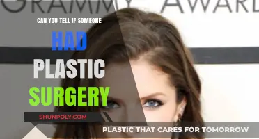 Spotting Plastic Surgery: Signs, Clues, and Subtle Tells to Look For