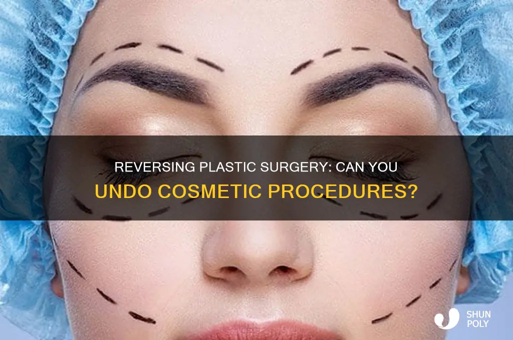 can you undo plastic surgery