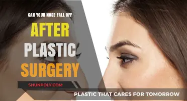 Can Your Nose Fall Off After Plastic Surgery? Facts Revealed