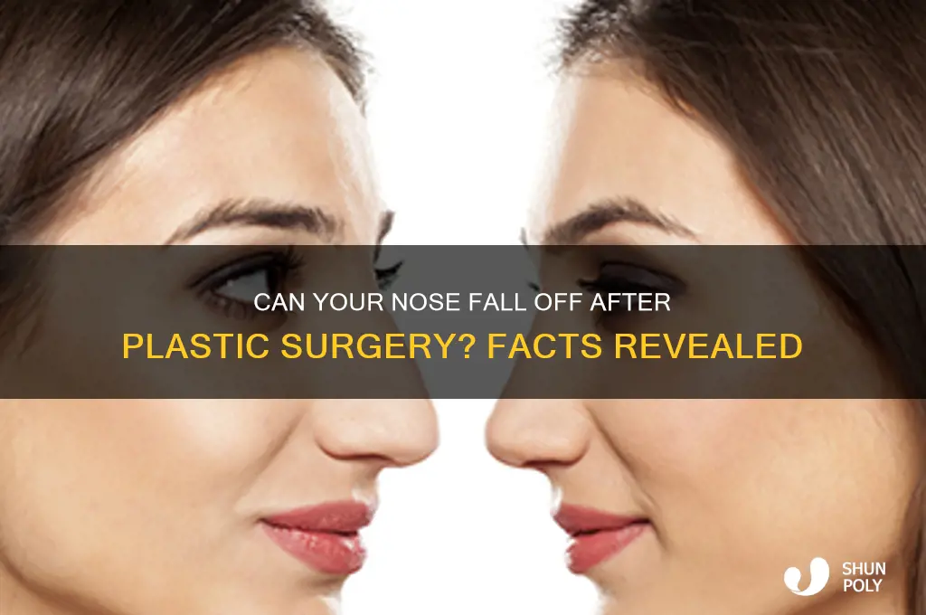 can your nose fall off after plastic surgery