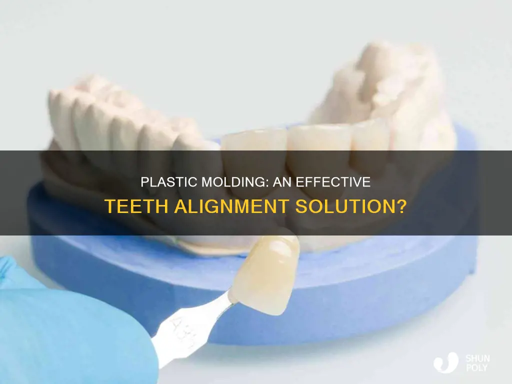 could plastic molds help align teeth