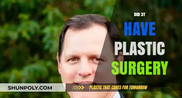 Unveiling the Truth: 3T's Transformation and Plastic Surgery Speculations