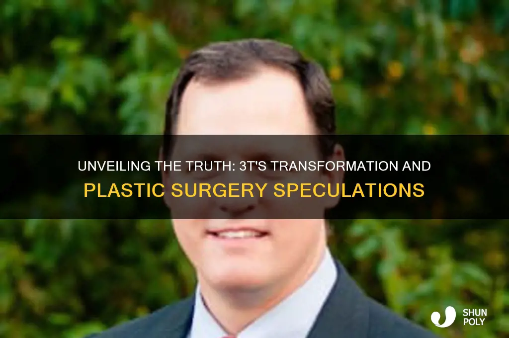 did 3t have plastic surgery