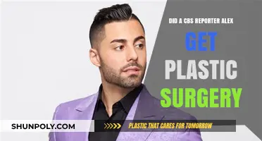 Did CBS Reporter Alex Undergo Plastic Surgery? Unveiling the Truth