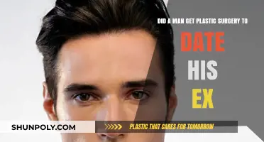 Man's Extreme Makeover: Plastic Surgery to Win Back His Ex?