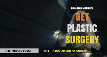 Aaron Moriarty's Transformation: Plastic Surgery Rumors Explored