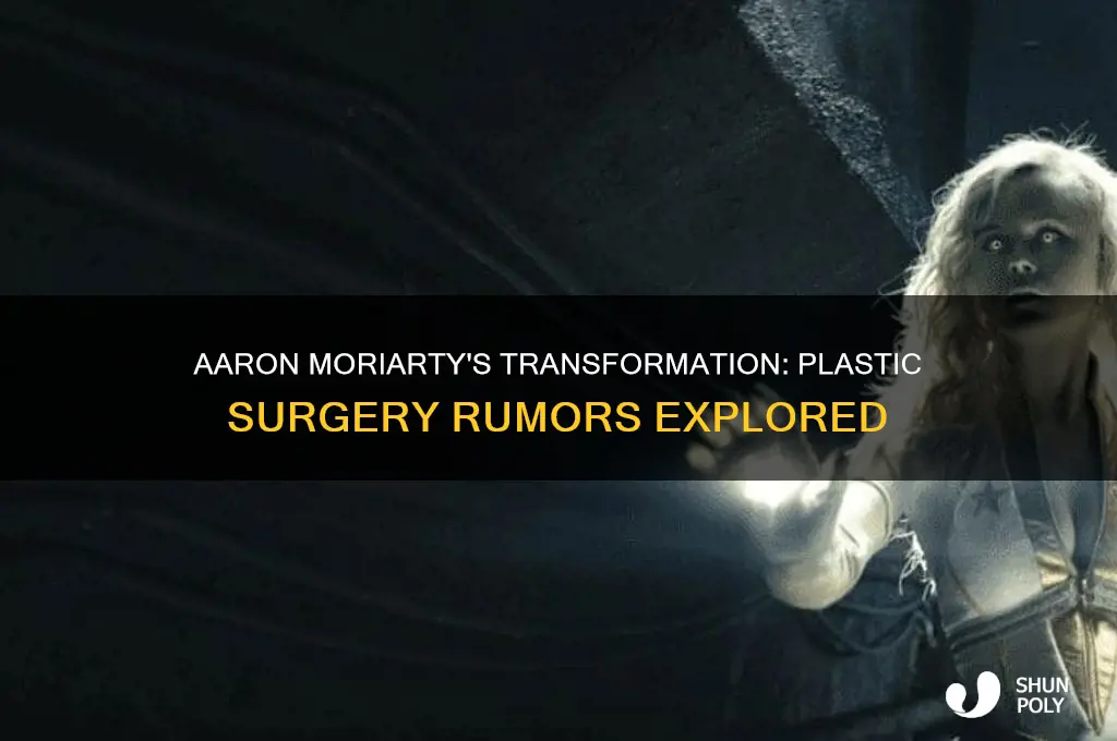 did aaron moriarty get plastic surgery