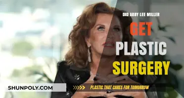 Abby Lee Miller's Transformation: Plastic Surgery Rumors Explored