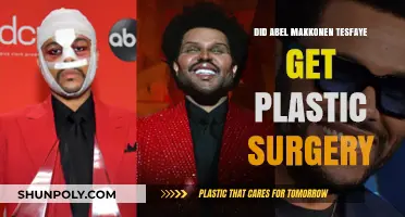 Did The Weeknd Undergo Plastic Surgery? Unveiling Abel Tesfaye's Transformation