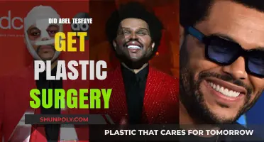 Did The Weeknd Undergo Plastic Surgery? Unveiling Abel Tesfaye's Transformation