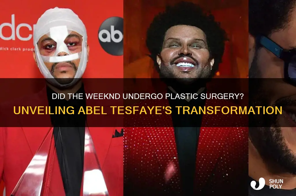 did abel tesfaye get plastic surgery