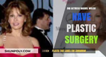 Raquel Welch's Transformation: Plastic Surgery Rumors and Reality Revealed