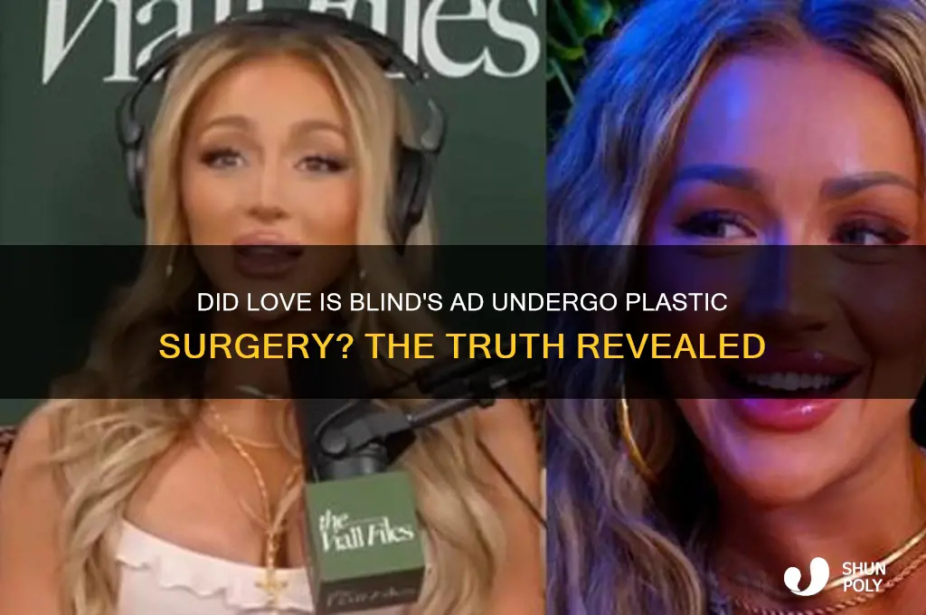 did ad from love is blind have plastic surgery