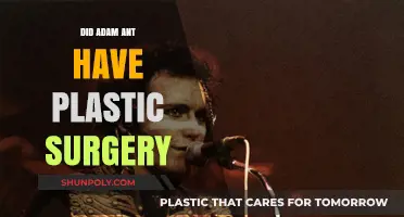 Adam Ant's Transformation: Plastic Surgery Rumors Explored and Debunked
