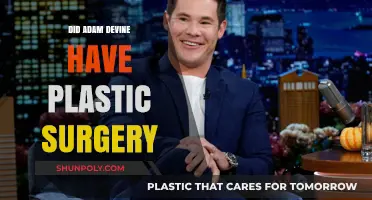 Adam Devine's Transformation: Plastic Surgery Rumors Explored