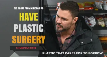 Did Chicago PD's Adam Ruzek Undergo Plastic Surgery? The Truth