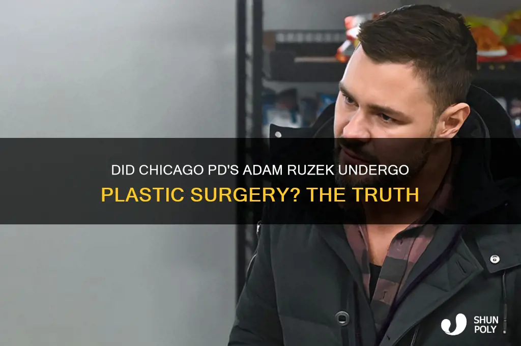 did adam from chicago pd have plastic surgery