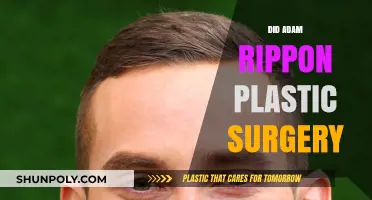 Adam Rippon Plastic Surgery: Fact-Checking the Rumors and Speculations