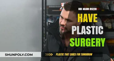 Adam Ruzek Plastic Surgery: Fact-Checking the Rumors and Speculations