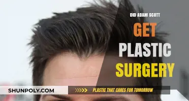Adam Scott Plastic Surgery: Fact or Fiction? Uncovering the Truth