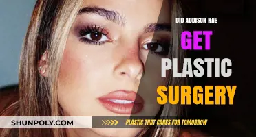 Addison Rae Plastic Surgery: Fact-Checking the Rumors and Speculations