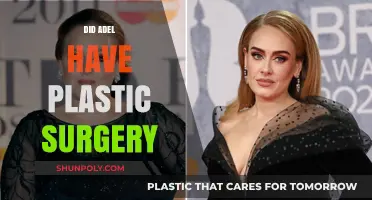 Did Adele Undergo Plastic Surgery? Unraveling the Truth Behind Her Transformation