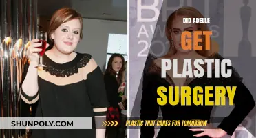 Adele's Transformation: Plastic Surgery Rumors and the Truth Behind Them
