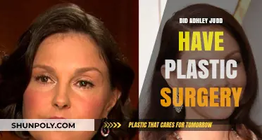 Ashley Judd's Transformation: Plastic Surgery Speculations and Truths Revealed