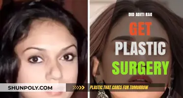 Aditi Rao Plastic Surgery: Fact-Checking the Transformation Rumors
