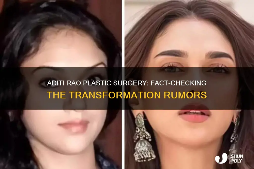 did aditi rao get plastic surgery