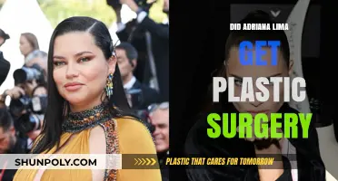 Adriana Lima's Transformation: Plastic Surgery Rumors Explored and Debunked