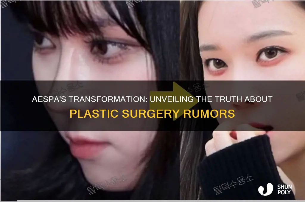 did aespa get plastic surgery
