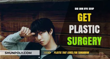Ahn Hyo Seop's Transformation: Plastic Surgery Rumors Explored