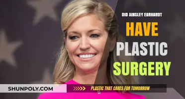 Ainsley Earhardt's Transformation: Plastic Surgery Speculations and Facts