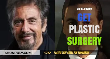 Al Pacino's Transformation: Plastic Surgery Rumors and Reality Revealed